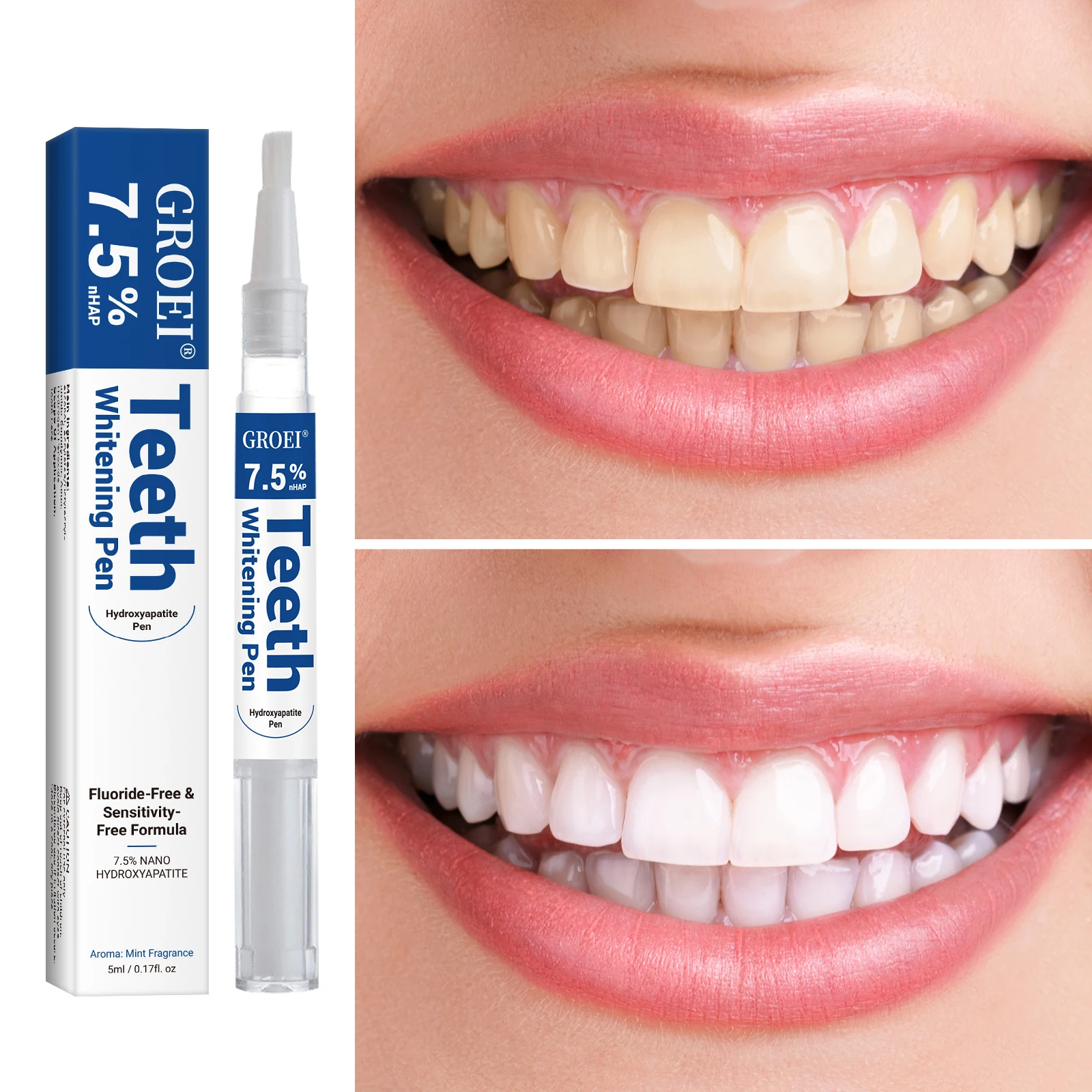 Hydroxyapatite Tooth Whitening – Teeth Whitening With Peroxide recenzja i cena