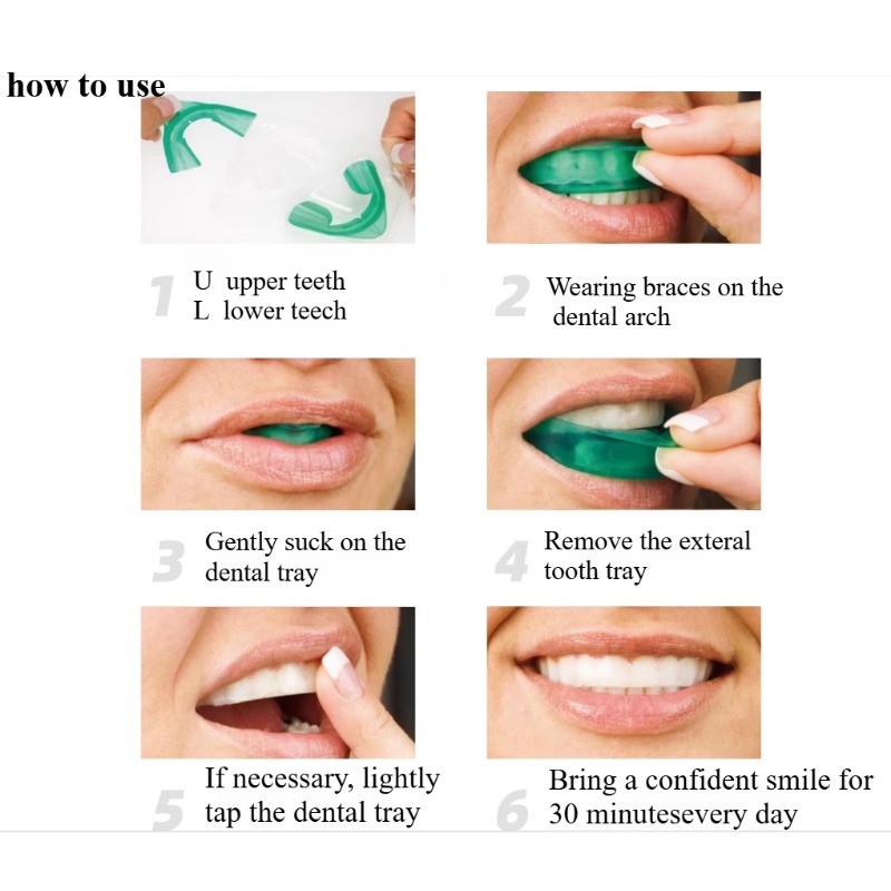 Set Teeth Whitening Tray U-sha – Teeth Whitening With Peroxide recenzja i cena