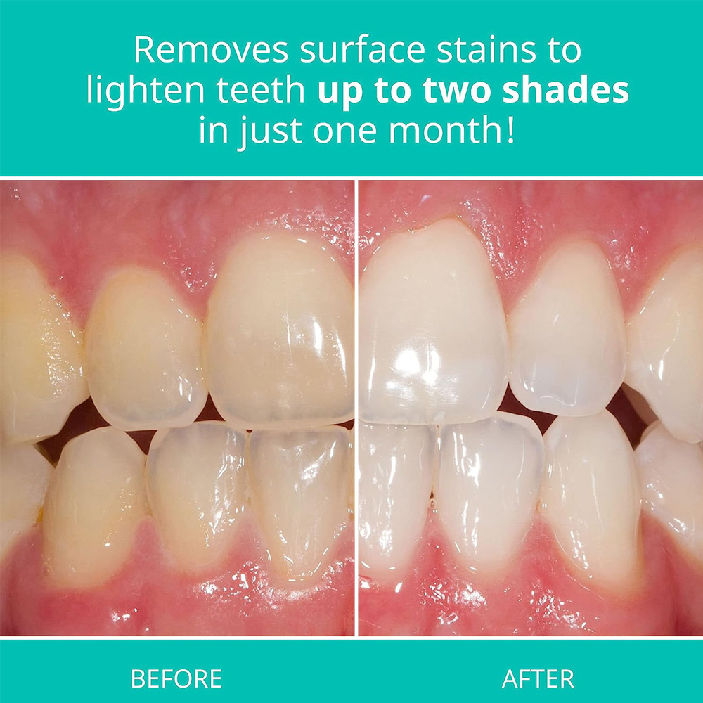 Opalescence Whitening Toothpas – Teeth Whitening Opalescence recenzja i cena