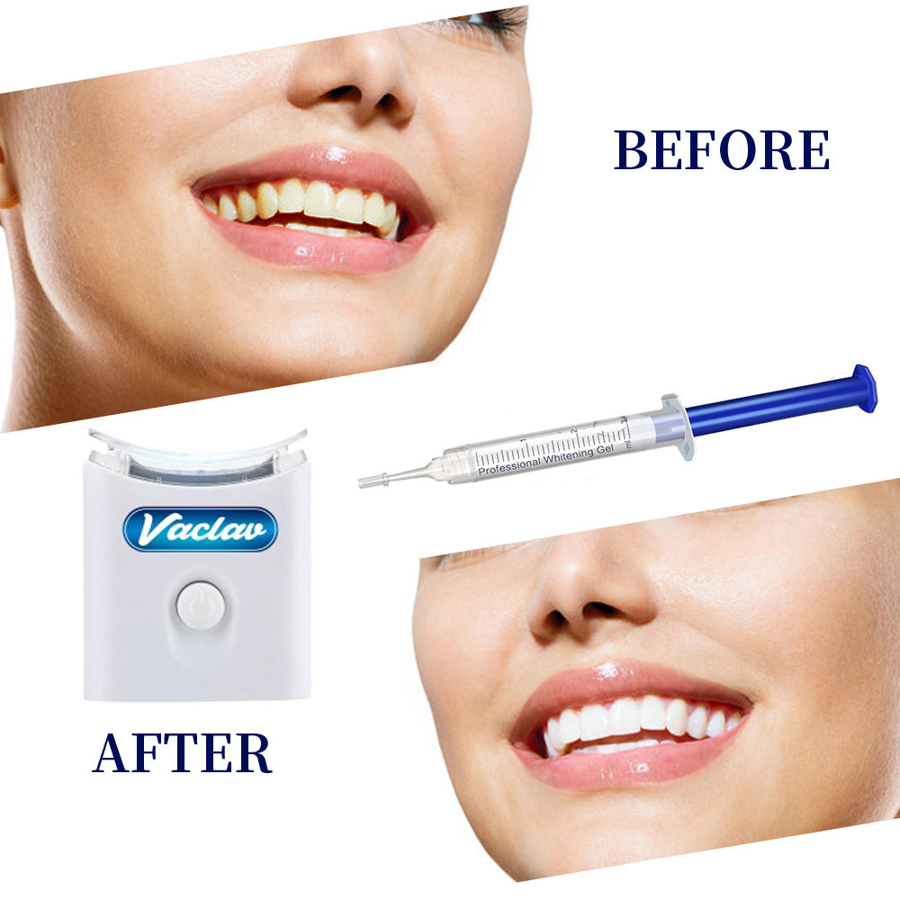 Mint Teeth Whitening Gel Syrin – Teeth Whitening Gel Syringes recenzja i cena