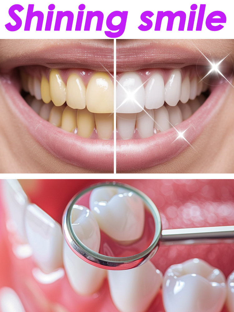 GlorySmile Teeth Whitening Fru – Teeth Whitening Xylitol recenzja i cena