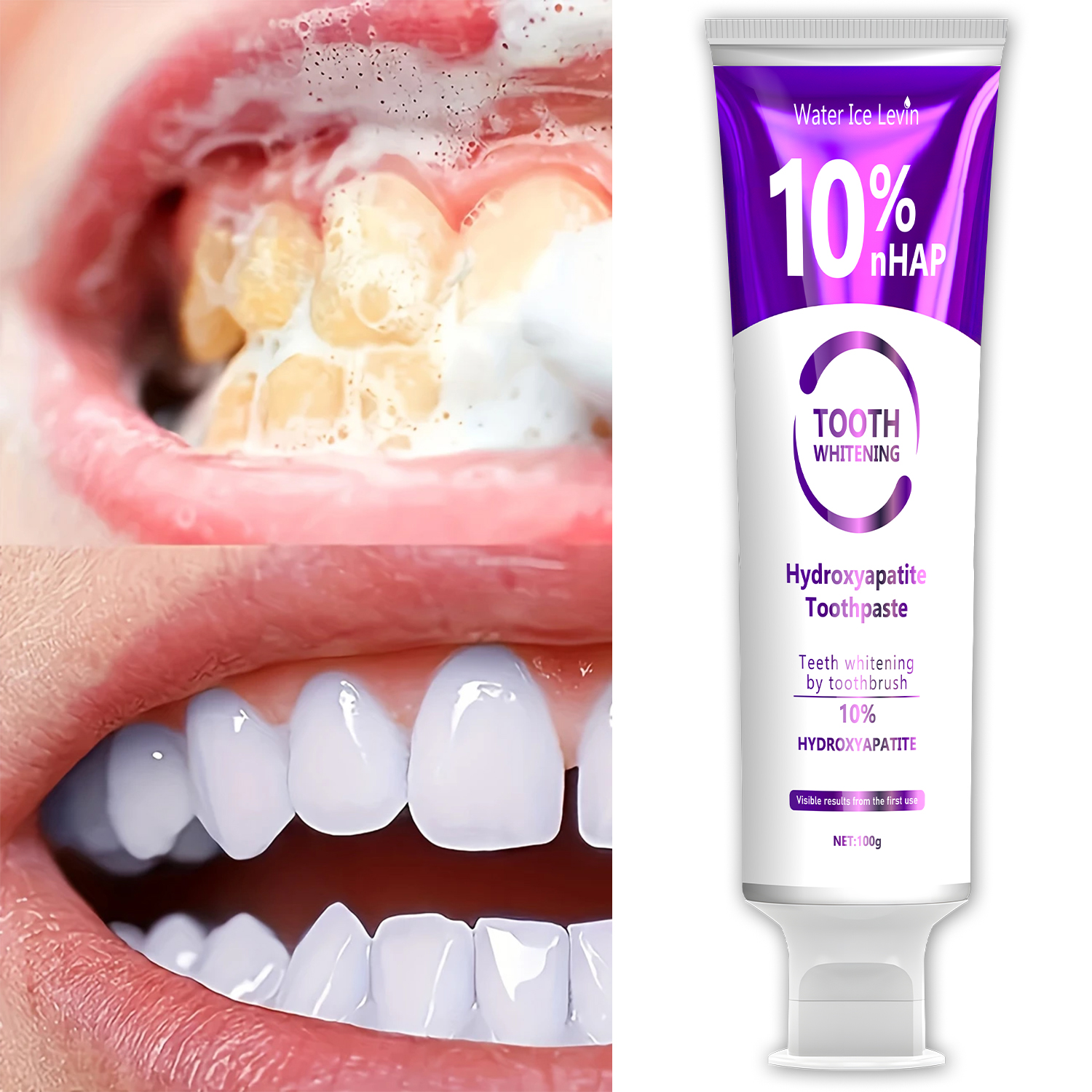 10% Nanoh Hydrogen Oxide Tooth – Teeth Whitening With Peroxide recenzja i cena