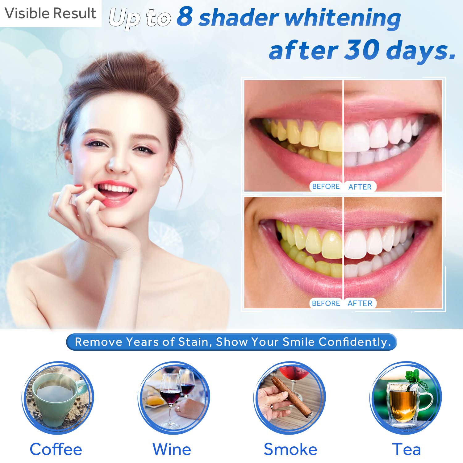 Teeth Whitening Gel Refill Syr – Teeth Whitening With Peroxide recenzja i cena