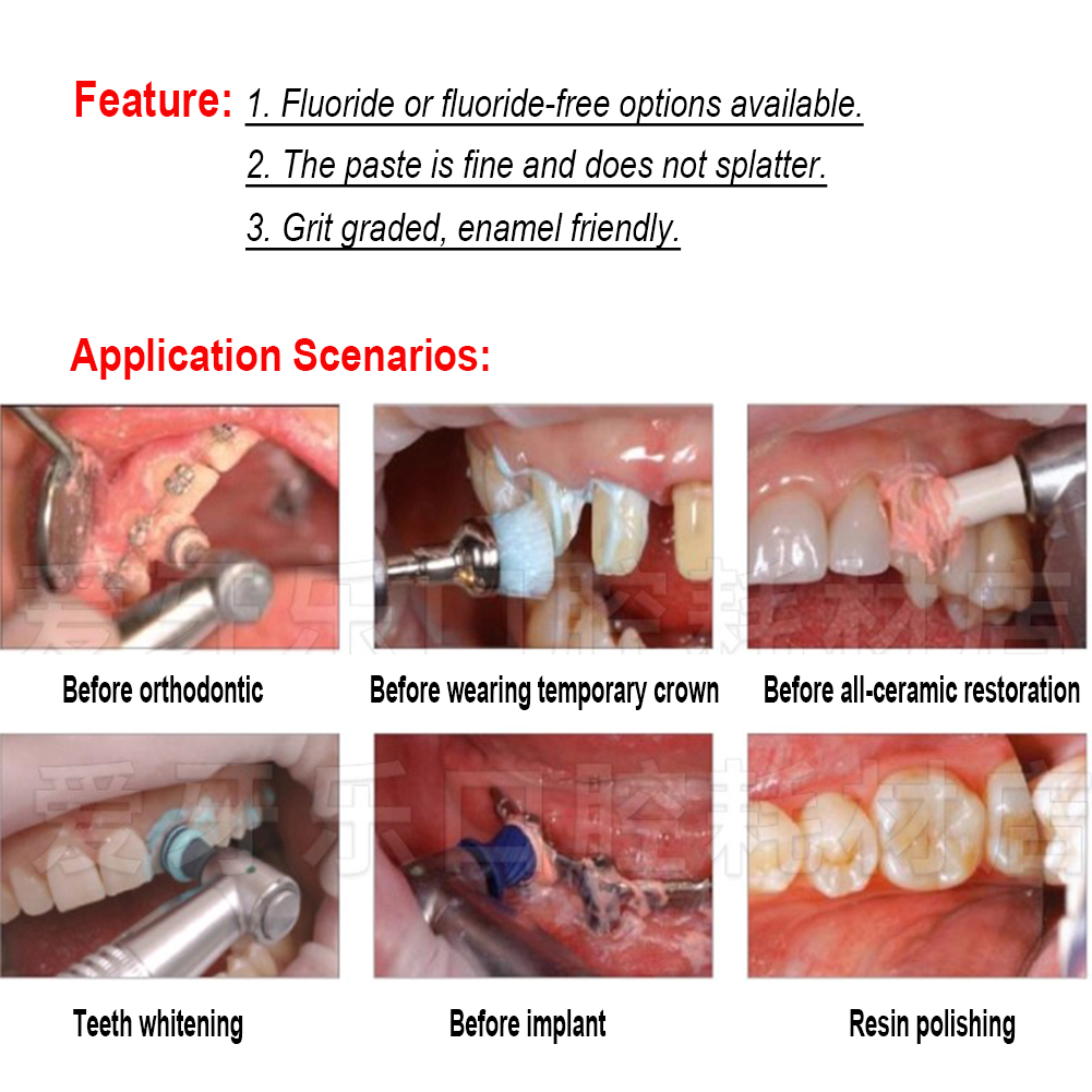 Ivoclar Vivadent Oral Teeth Po – Teeth Whitening Xylitol recenzja i cena