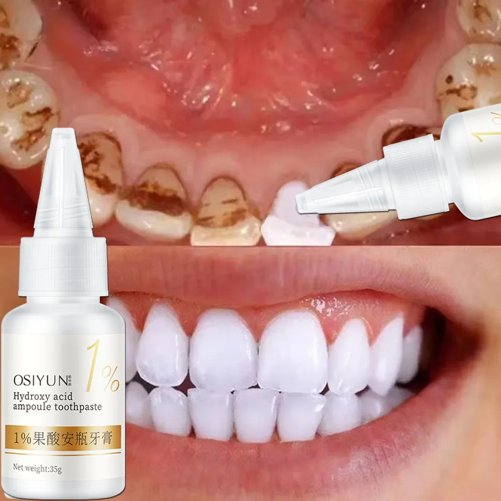 Teeth Whitening Toothpaste Fru – Teeth Whitening Xylitol recenzja i cena