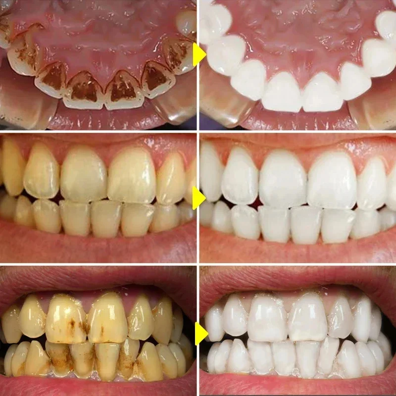 Teeth Whitening Toothpaste Fru – Teeth Whitening Xylitol recenzja i cena