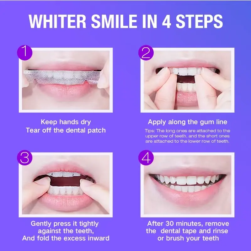 Teeth Whitening Kit - 5X LED L – Teeth Whitening With Peroxide recenzja i cena
