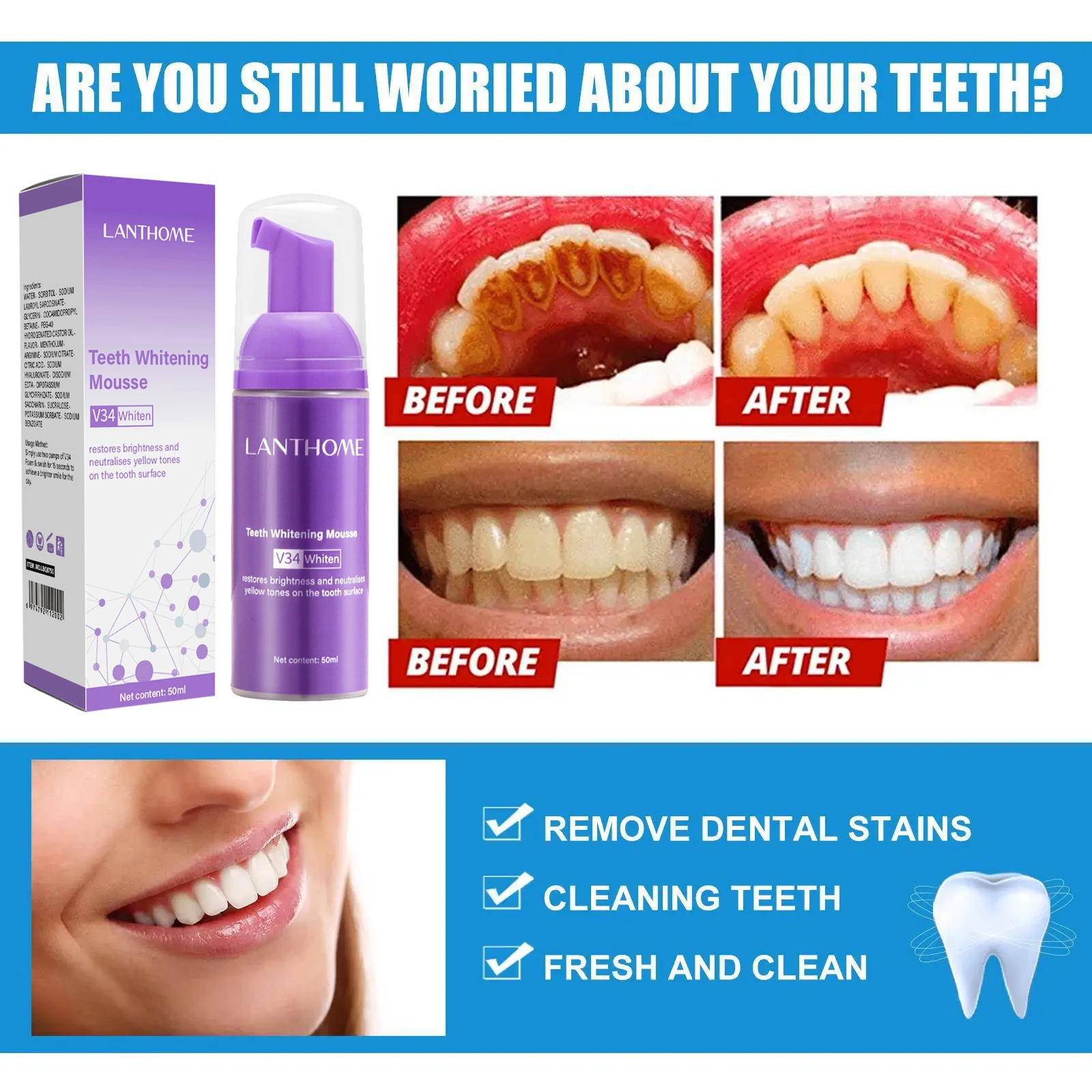 V34 Teeth Whitening Mousse Too – Teeth Whitening Xylitol recenzja i cena