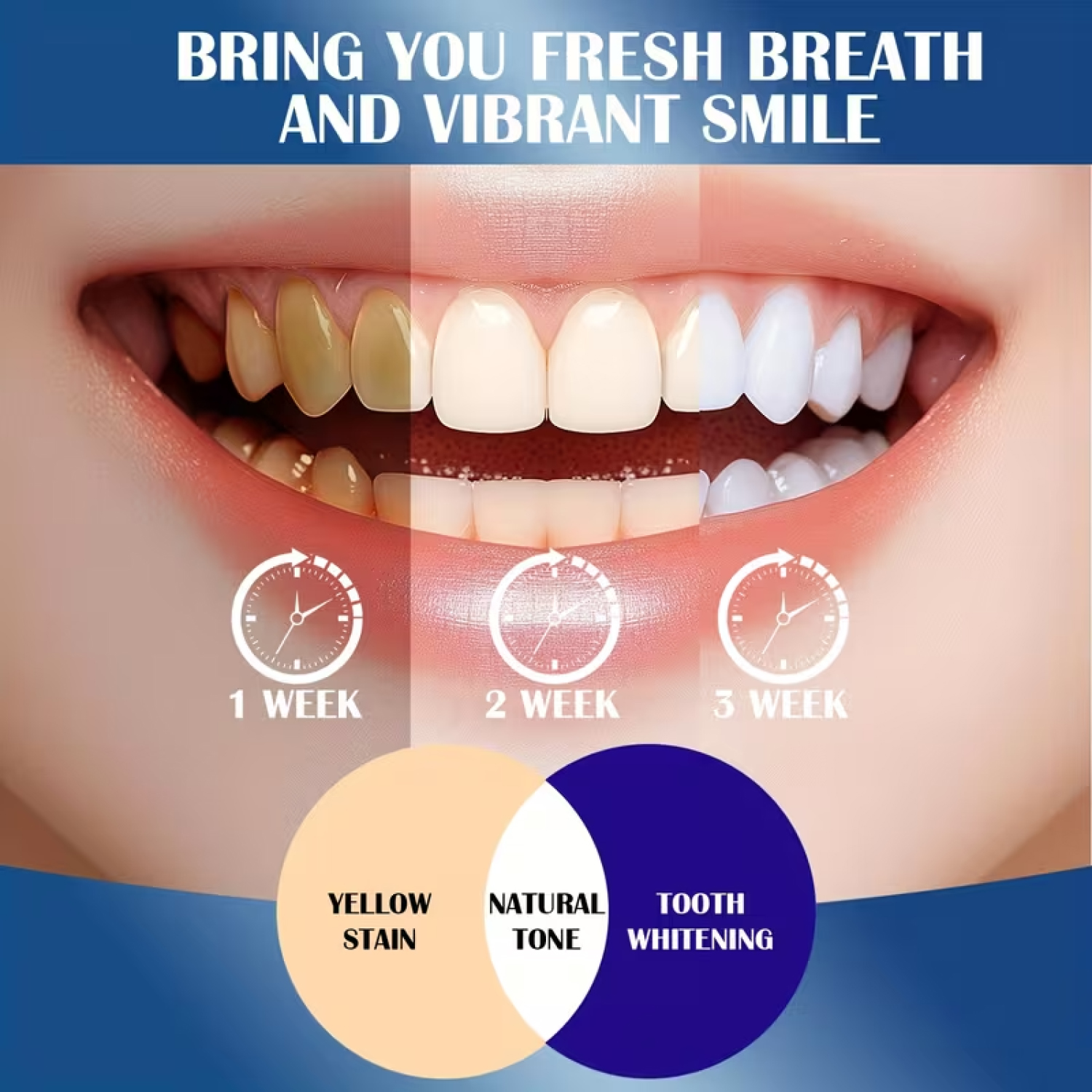 20% Hydroxyapatite Toothpaste. – Teeth Whitening Opalescence recenzja i cena