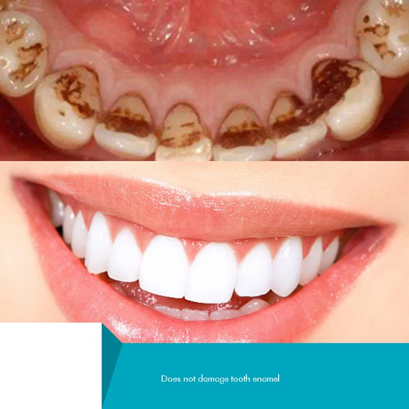Herbal Tooth Powder, Natural T – Teeth Whitening Xylitol recenzja i cena