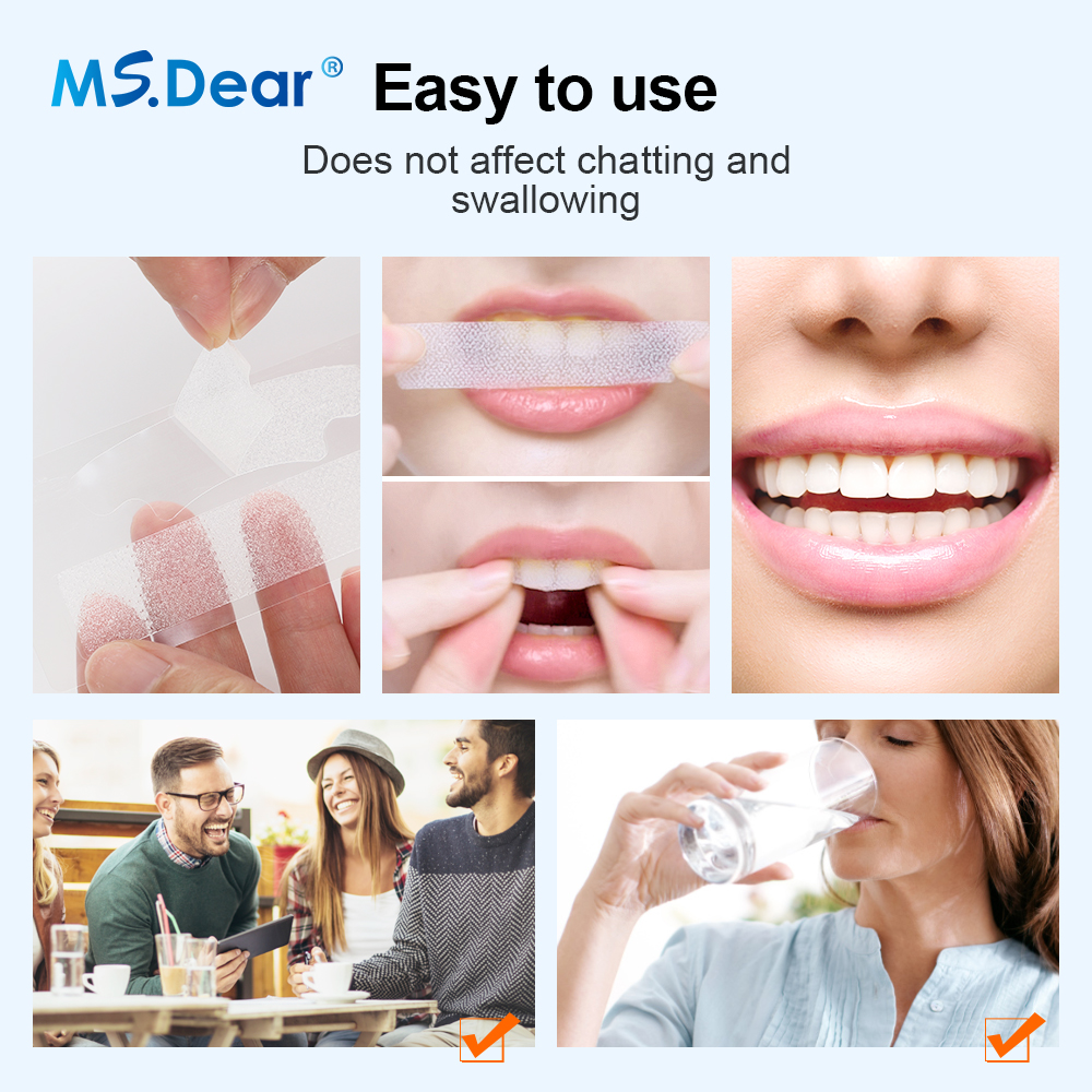 Teeth Whitening Strips Cleansi – Teeth Whitening With Peroxide recenzja i cena